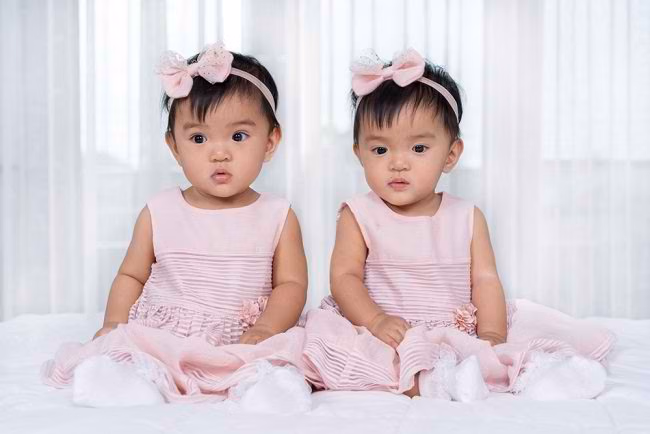 bayi kembar