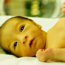 bayi kuning